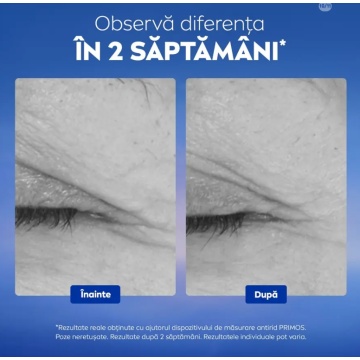 Serum pentru ochi NIVEA Cellular Epigenetics cu Epicelline®, 15ml 3786 - Img 5