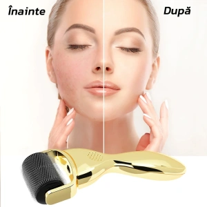 Rola Dermatologica 3 in 1 - Capete Detasabile, Masaj Facial, Regenerarea Pielii, 0,25/0,5/1,5 mm - Img 2