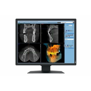 Monitor Eizo 21" MX217-SB