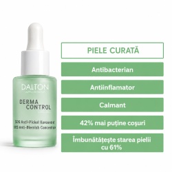 Ser concentrat ten gras anti-coșuri și acnee Derma Control SOS Anti-Blemish Concentrate