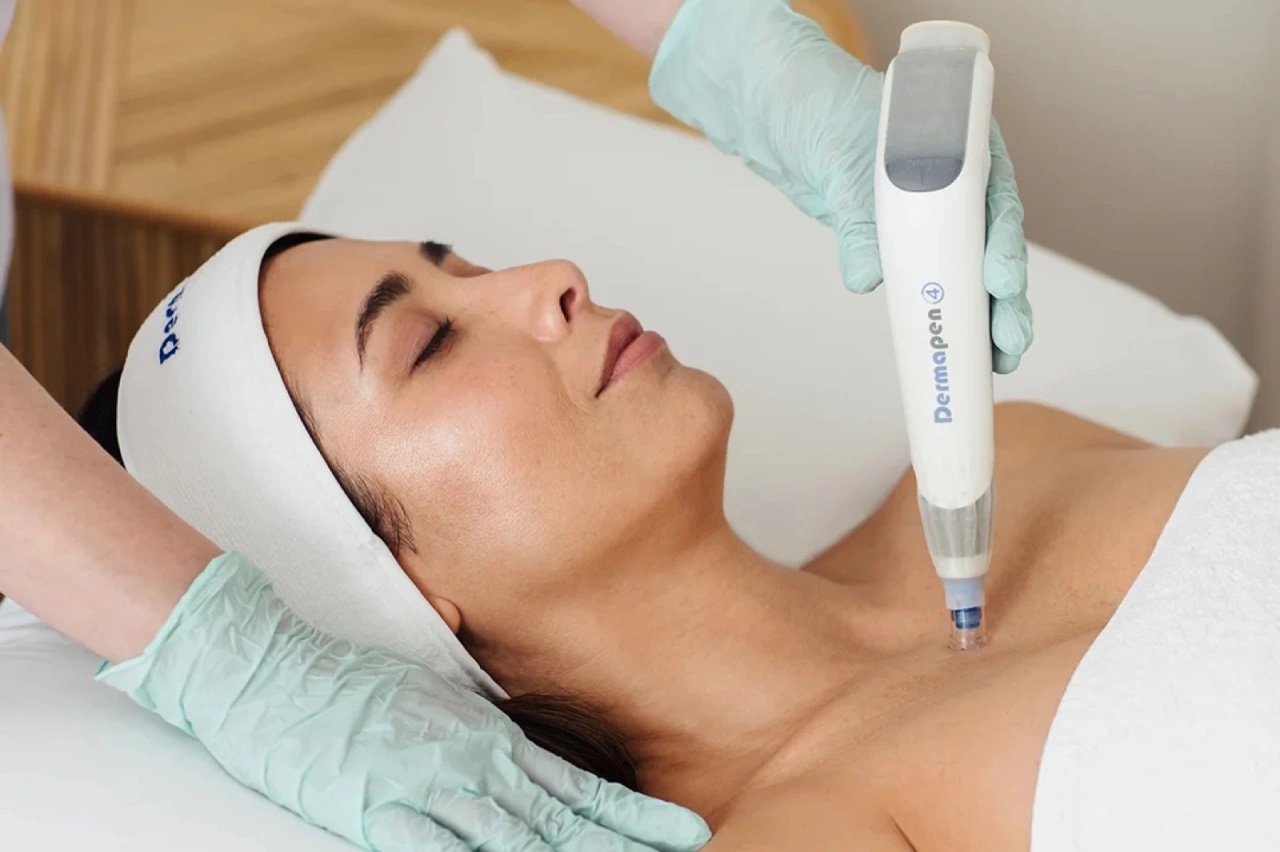 Dermapen la Clinica Oficina