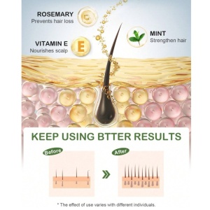 Ulei de rozmarin pentru de par si scalp de rozmarin, uz extern, 15 ml - Img 4