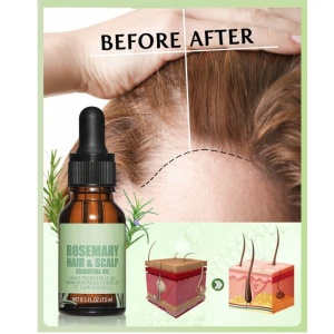 Ulei de rozmarin pentru de par si scalp de rozmarin, uz extern, 15 ml