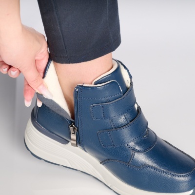 Ghete dama piele naturala imblanite – MELISSA Navy - Img 2
