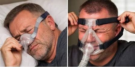 masca CPAP prea stransa comparata cu masca ajustata corect