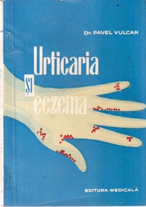 Dr. Pavel Vulcan - Urticaria si eczema