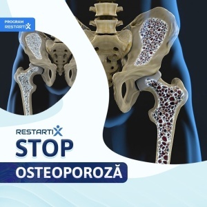 RestartiX Stop Osteoporoză