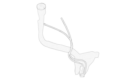 Rezervor spalator (contine: rezervor, umplutura, motor de spalat) potrivit CITROEN C4 CACTUS 09.14-