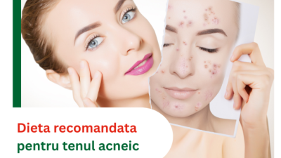 Dieta recomandata pentru tenul acneic