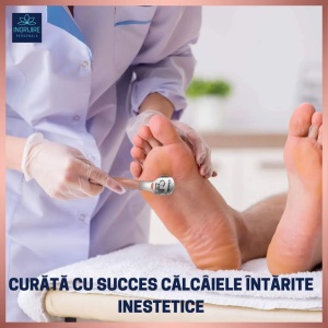 Instrument pentru curatarea calcaielor, calusuri, cu lama interschimbabila, otel inoxidabil - Img 2